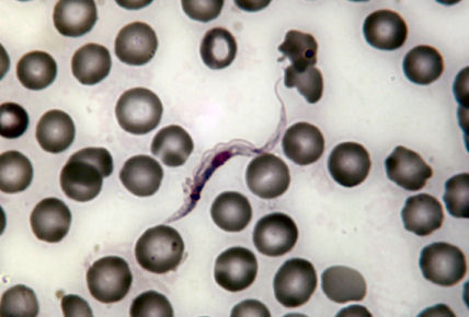 Trypanosoma-cruzi